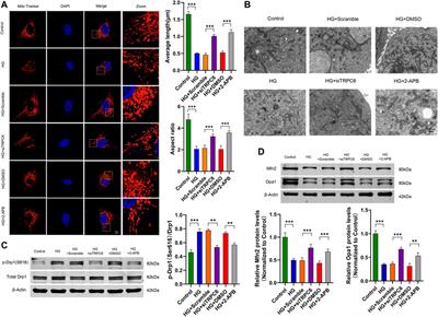 TRPC6 mediates high glucose-induced mitochondrial fission through activation of CDK5 in cultured human podocytes